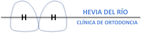 ORTODONCIA HEVIA DEL RIO